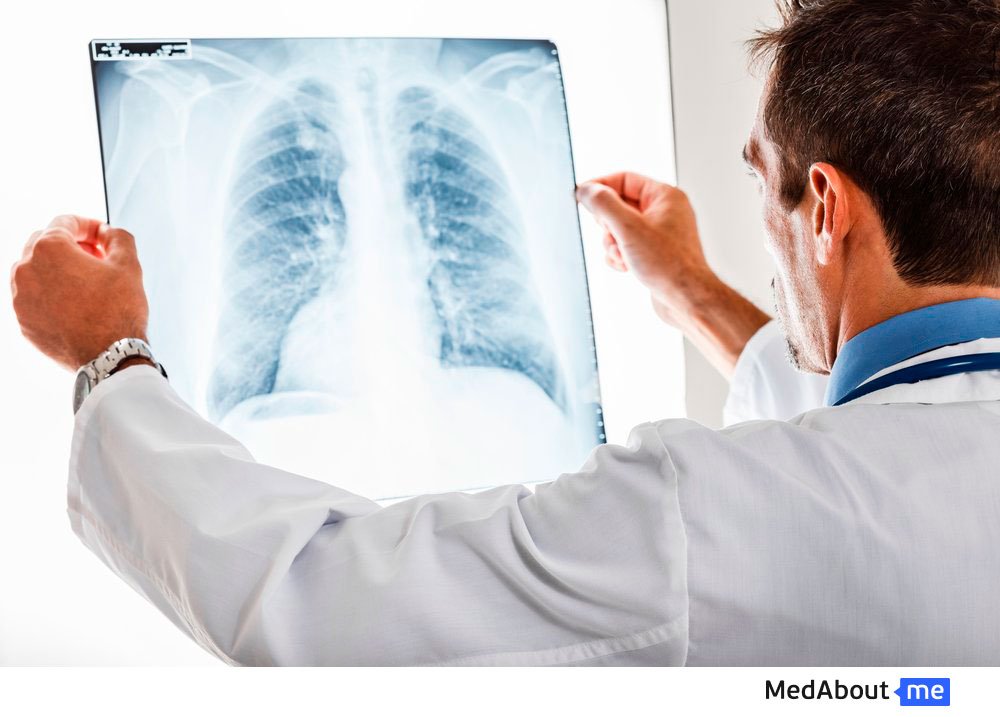 Рентгенография грудной клетки: обследование легких