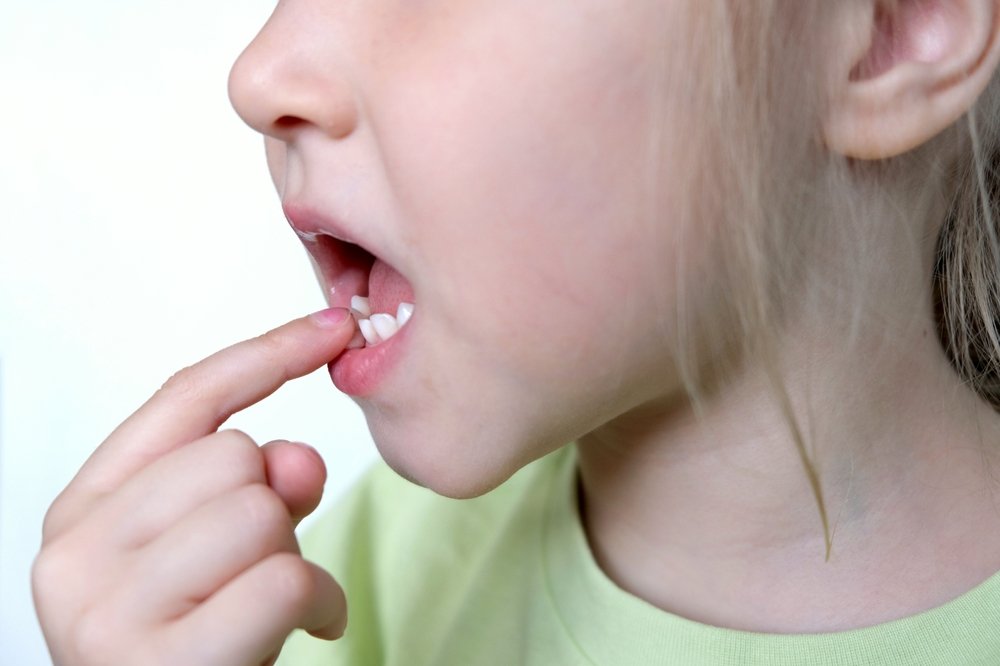 Лечат ли молочные зубы у детей?