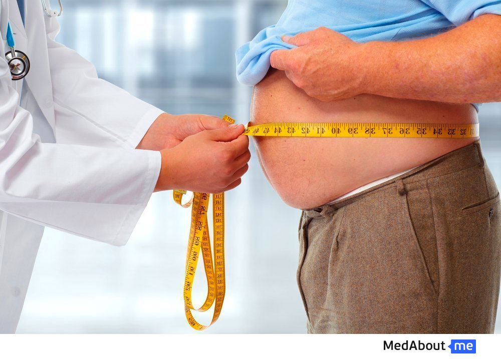 Шунтирование желудка при ожирении