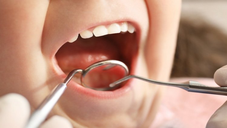 Серебрение зубов: преимущества и недостатки