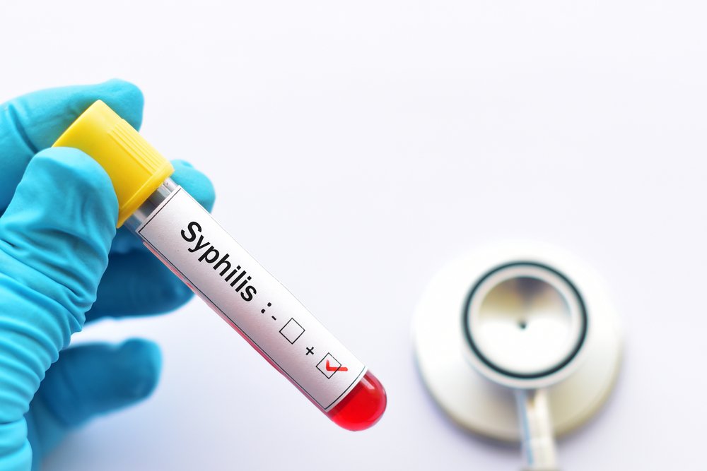 Тест Вассермана и антитела к сифилису