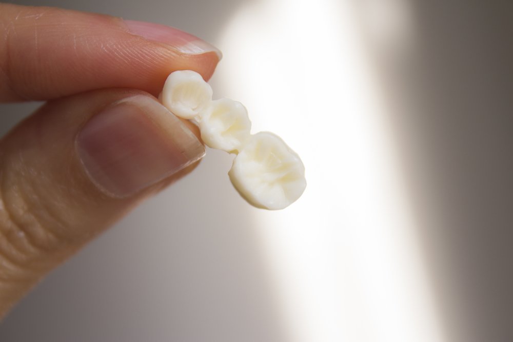 Ошибки стоматологов при протезировании