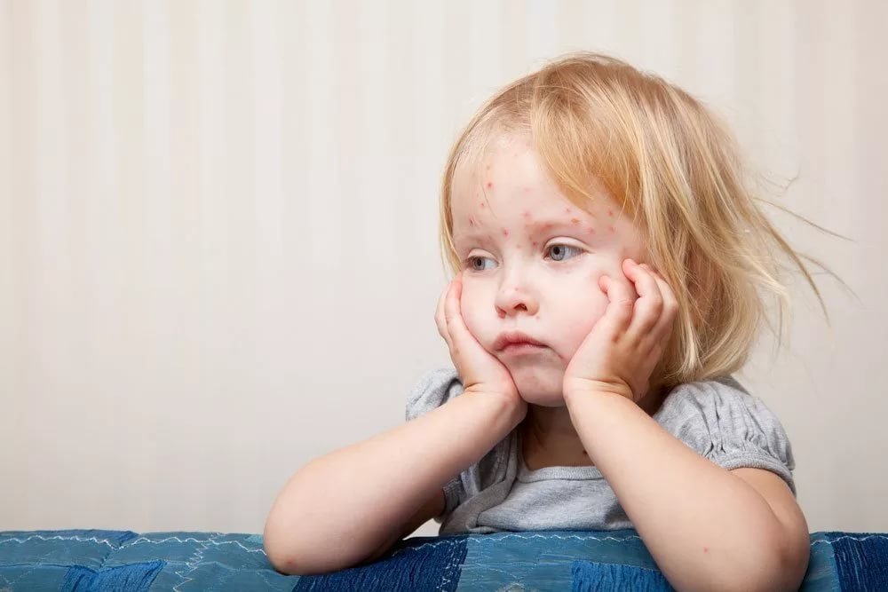 3. Игнорирование родителями симптомов аллергии малыша
