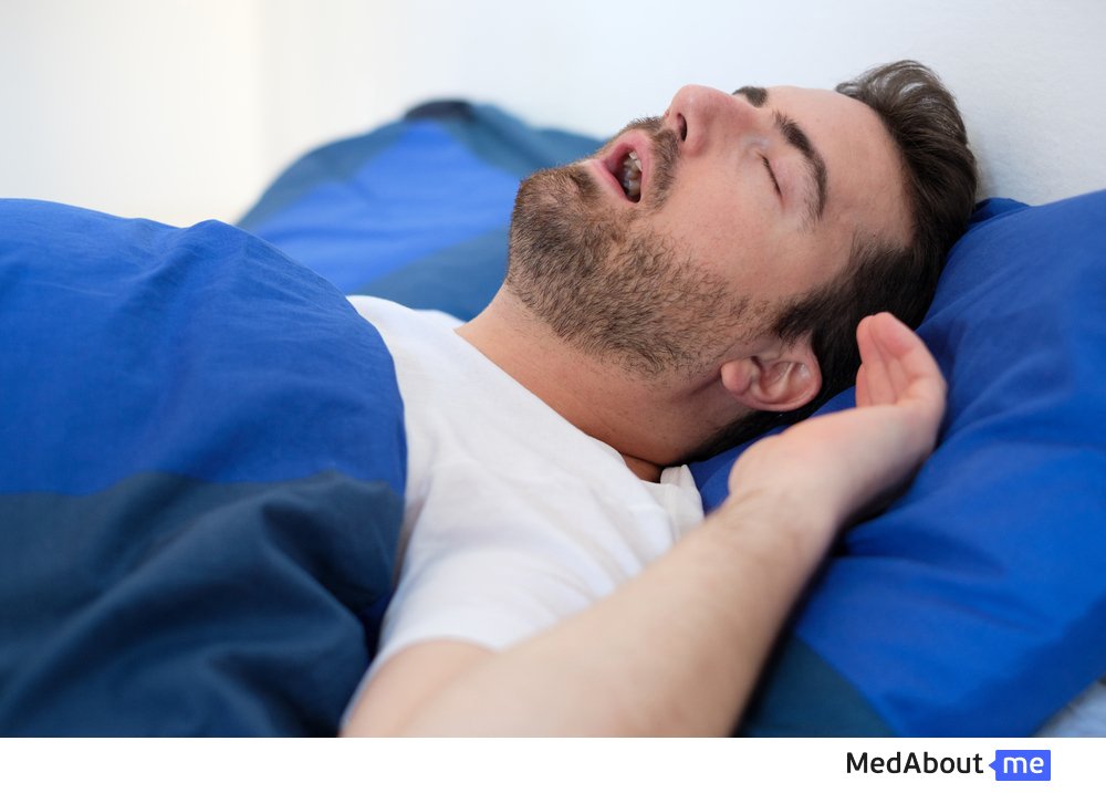 Что такое апноэ во время сна и чем оно опасно?
