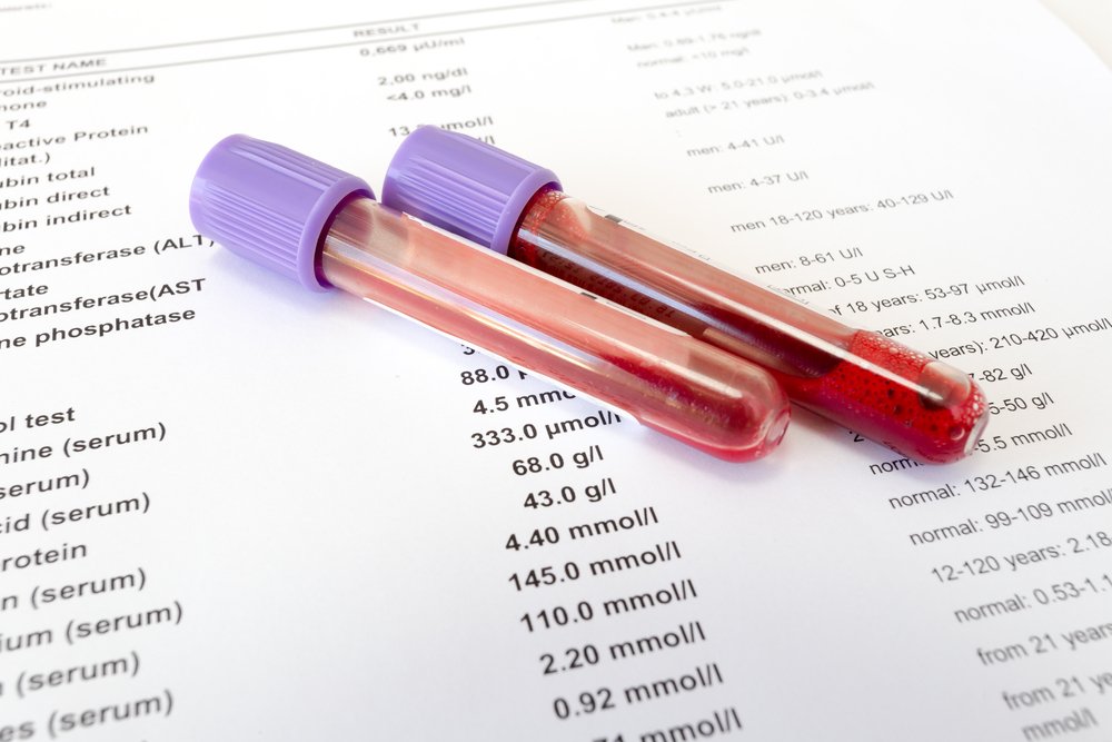 Какой уровень гемоглобина в общих анализах считается нормой?