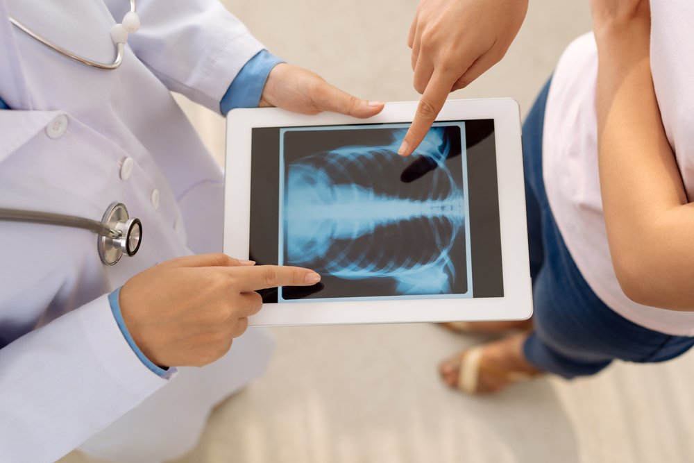 Рентген и беременность