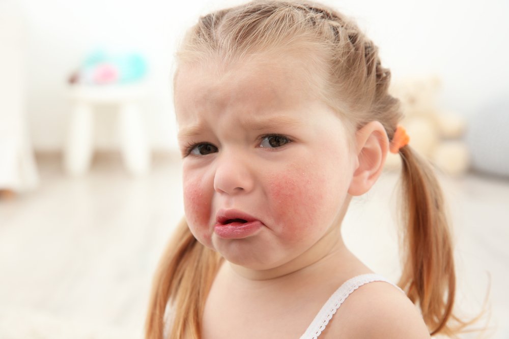 ПКИТ и СЛИТ как лечение аллергии — в чем разница?