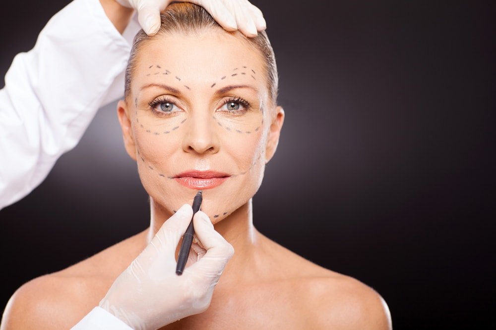 Основные принципы проведения операции по подтяжке кожи лица