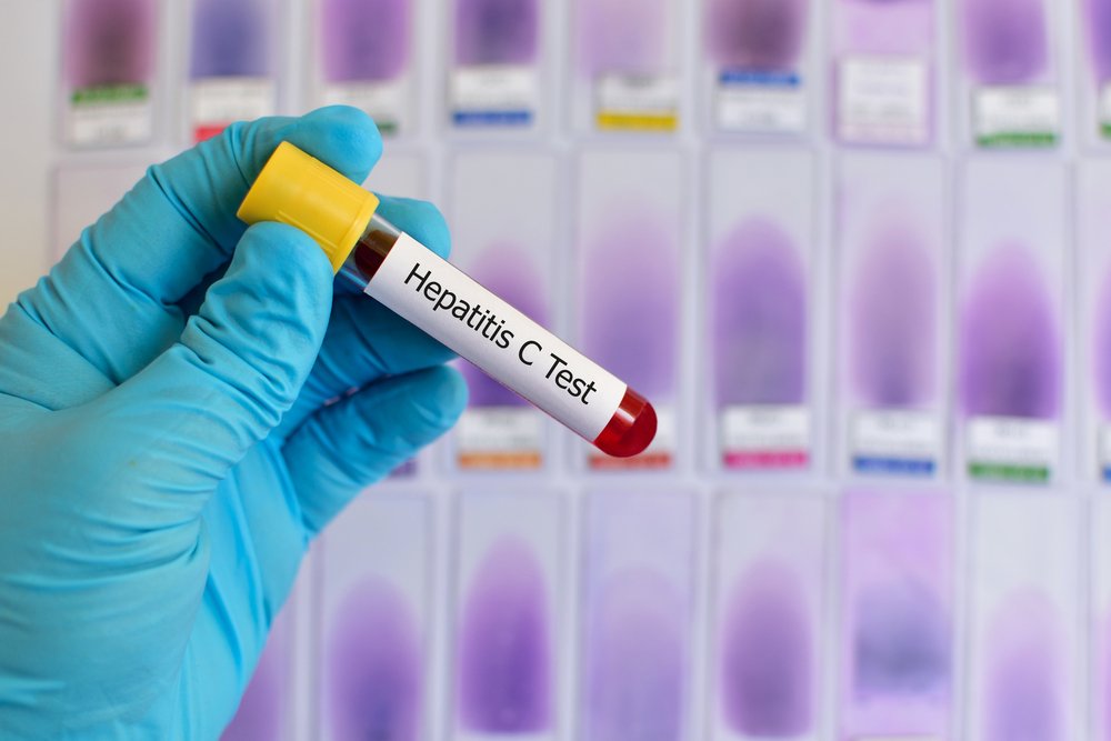 Анализ на гепатит