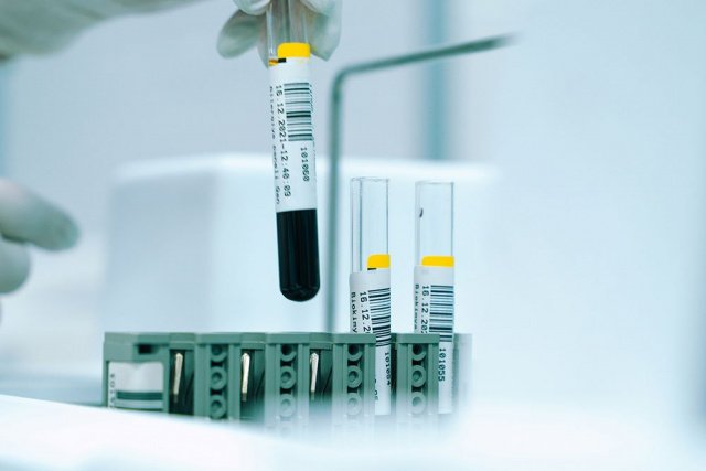 Неонатальный скрининг расширенный: какие заболевания выявляют сейчас