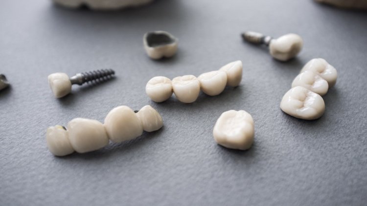 Пломбирование, вкладка, коронка — что скажет стоматолог?