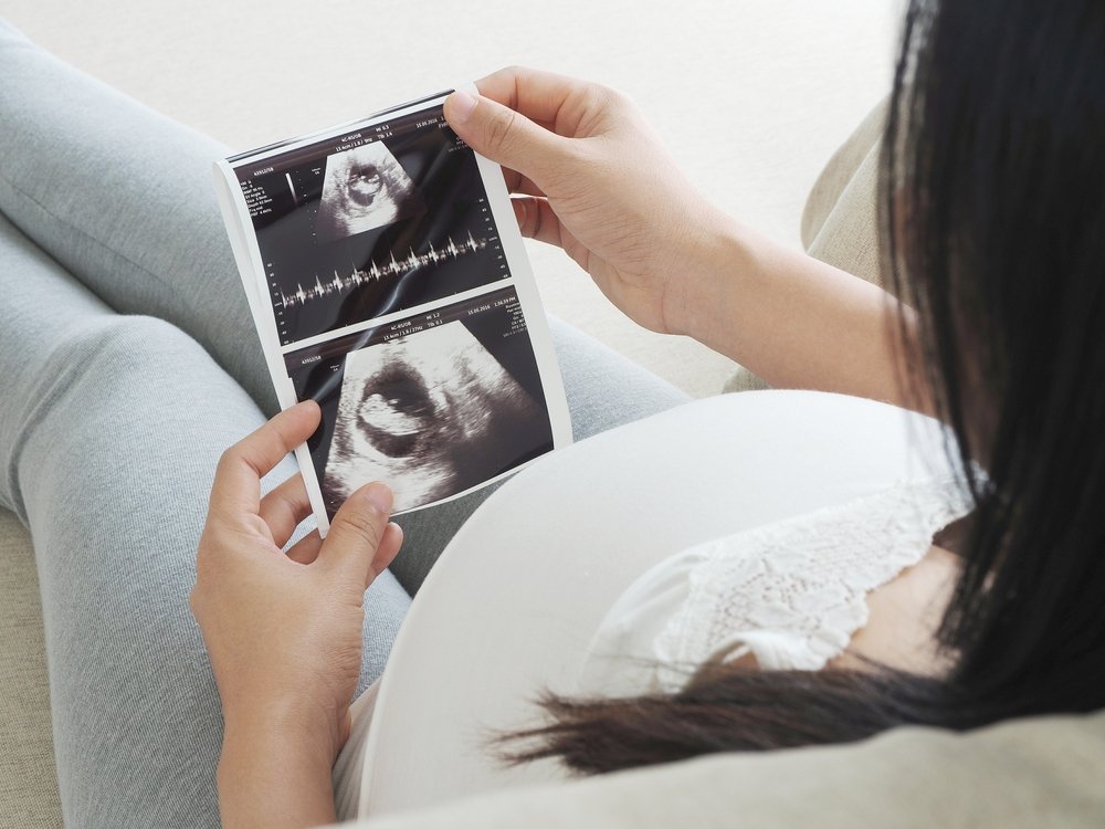 Методы диагностики и ведения женщин с многоплодной беременностью