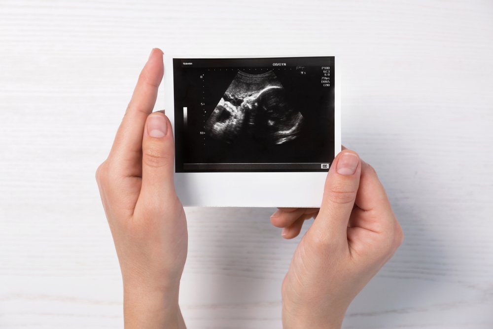 Необходимость прохождения УЗИ на ранних сроках беременности