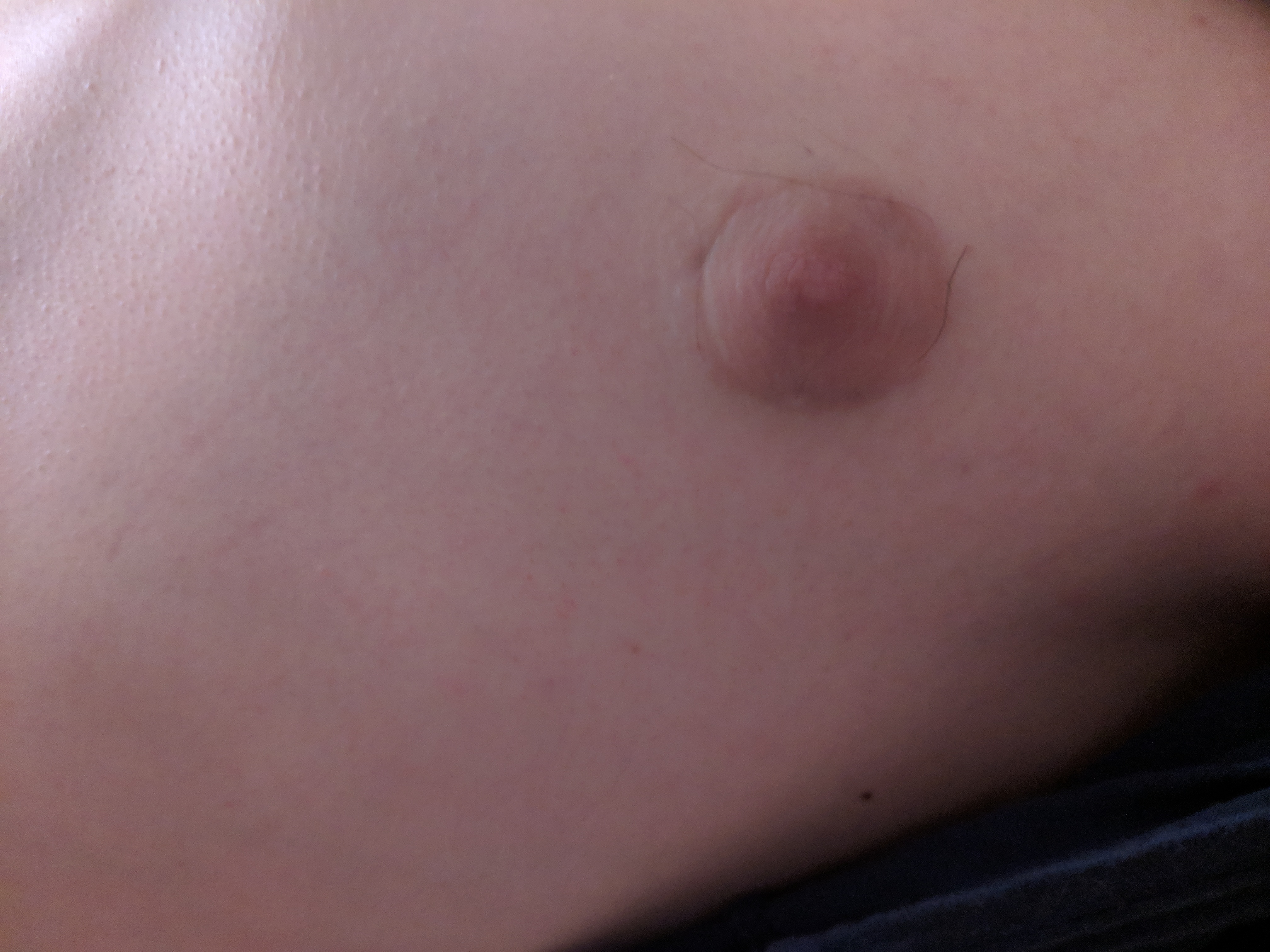увеличенный сосок груди у мужчин фото 92