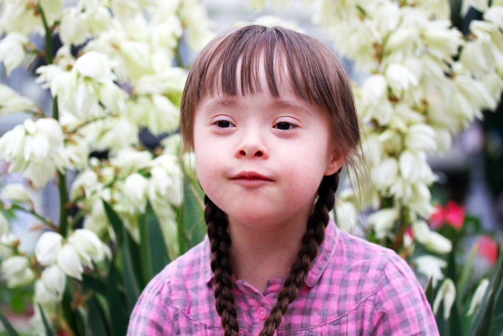 Фото солнечных детей с синдромом дауна