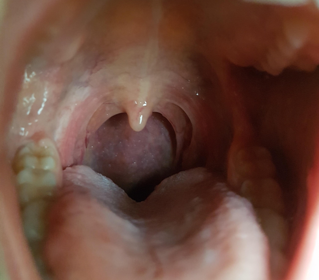 можно ли вылечить горло спермой фото 68