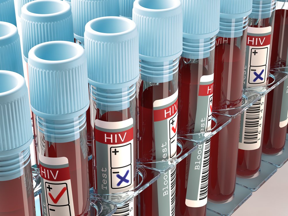 Через сколько времени и как проявляется ВИЧинфекция? Medaboutme.ru Через сколько времени и как проявляется ВИЧинфекция? Medaboutme.ru