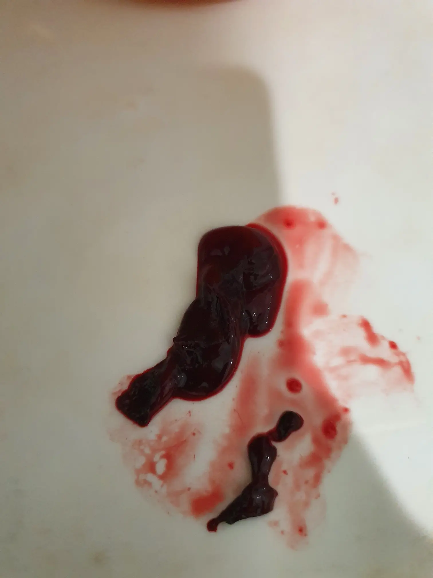 кровяные сгустки в сперме у мужчин фото 41