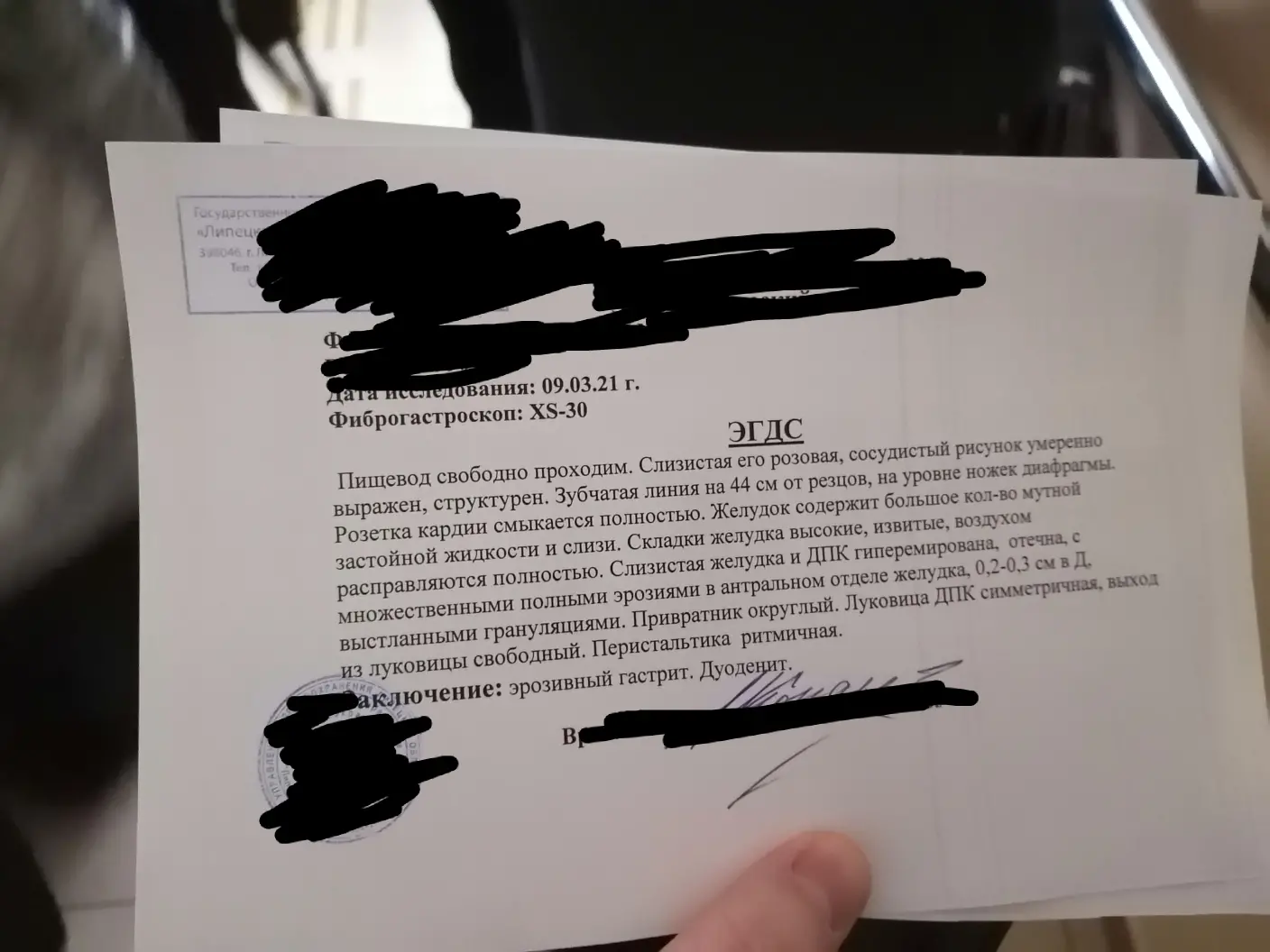 Хиатальная грыжа У меня аксиальная хиатальная грыжа. Дистальный ...