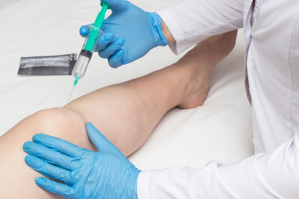 Как используется гиалуроновая кислота для суставов? – Medaboutme.ru