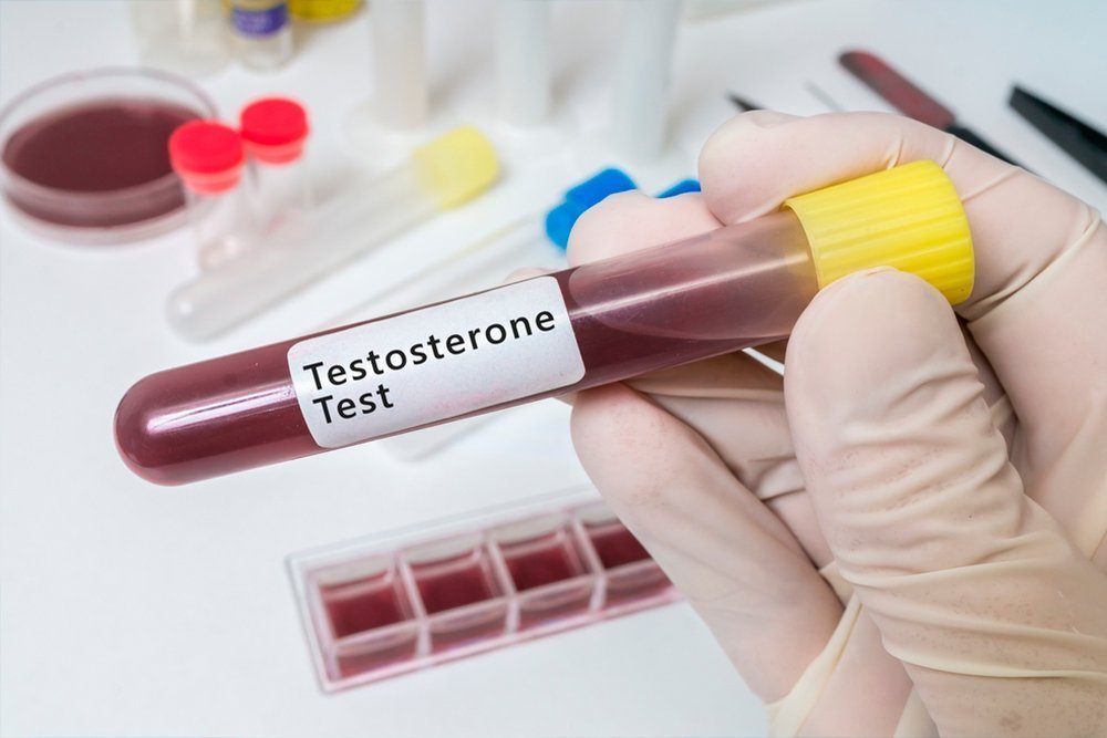 Свободный тестостерон (Free Testosterone) – Medaboutme.ru