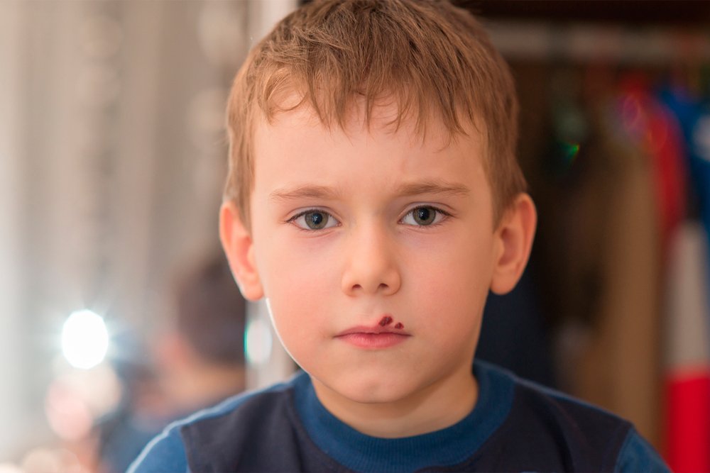 Герпес на губах у ребенка: причины, симптомы, лечение thumbnail