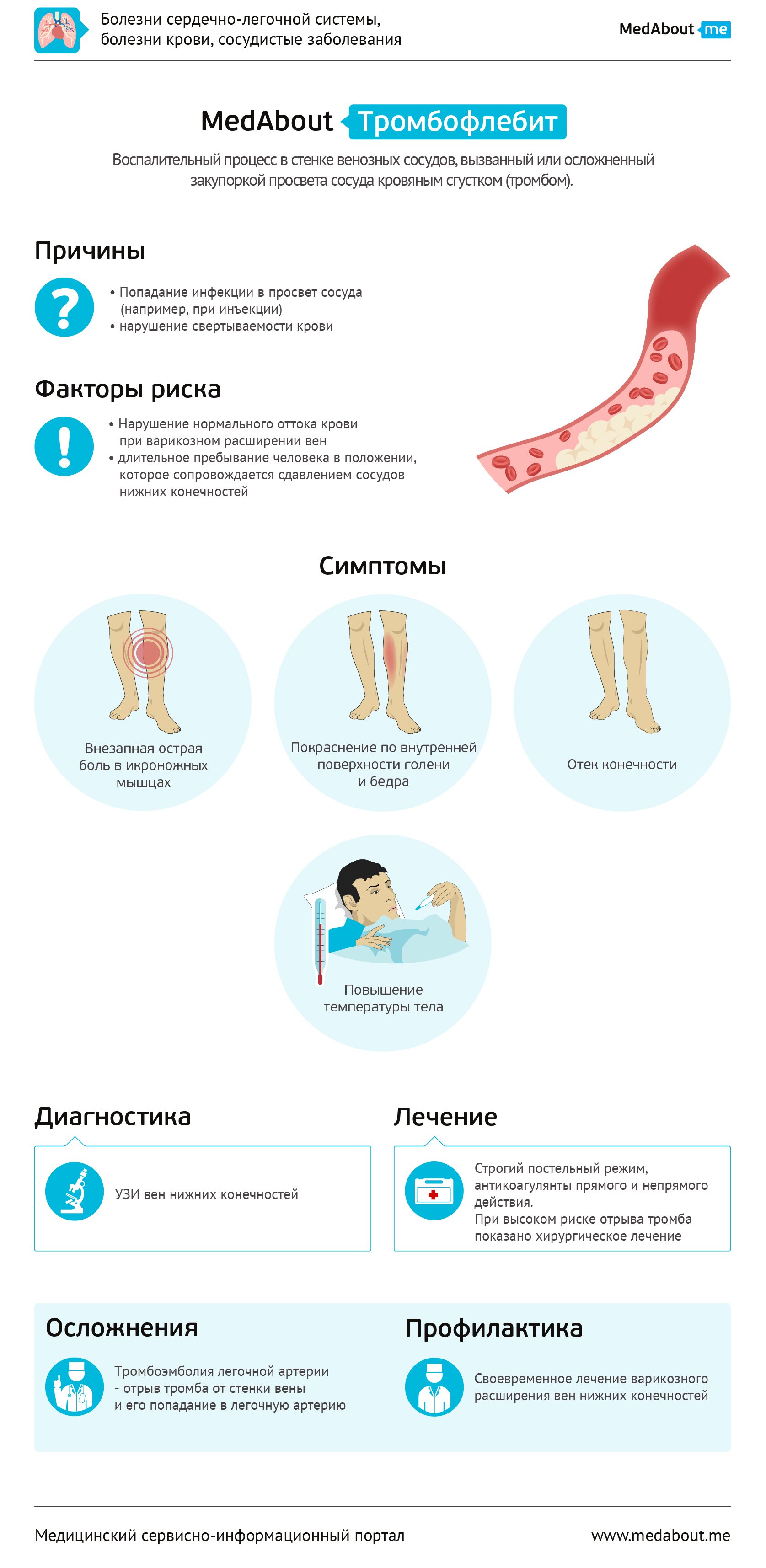 Схемы лечения тромбофлебита нижних конечностей