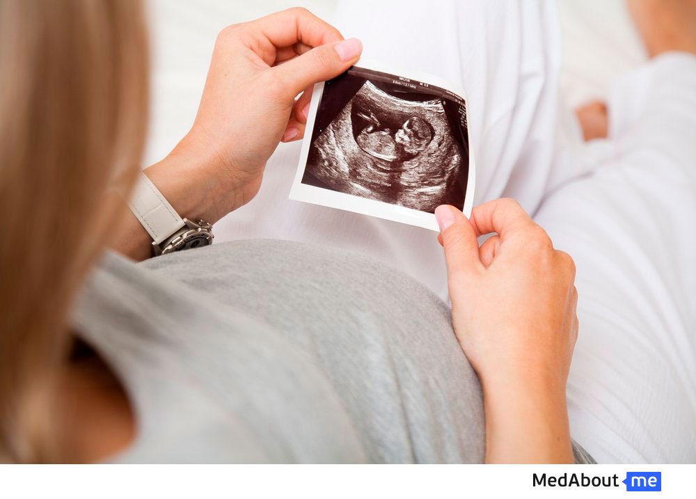 Как выглядит эмбрион человека на УЗИ (ультразвуковое исследование)?