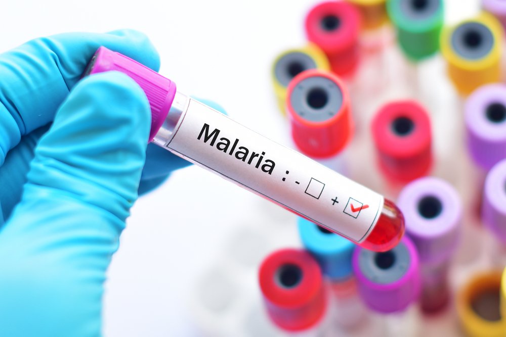 Тактика лечения малярии