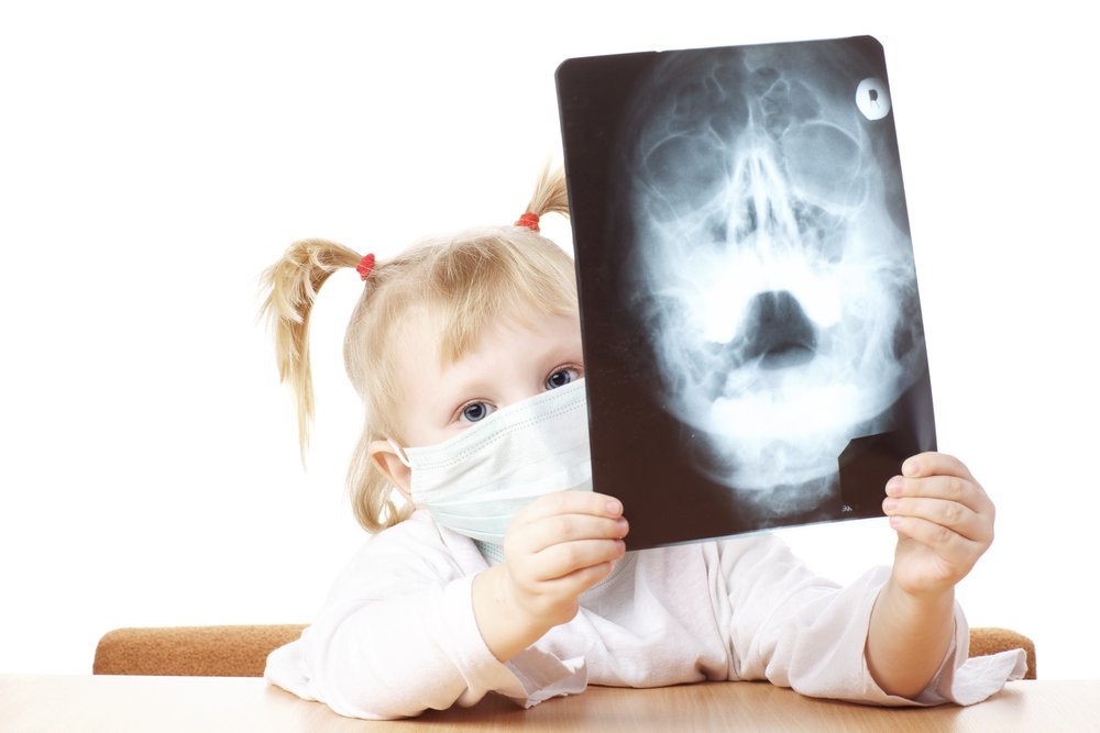 Зачем нужна рентгенография в педиатрии?