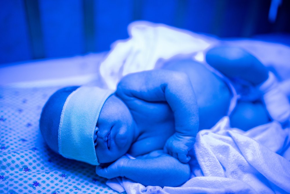 Принципы лечения желтухи у новорожденных