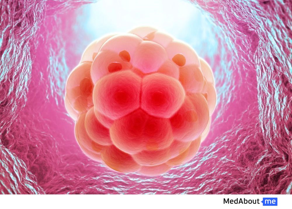 Прикрепление эмбриона к стенке матки после ЭКО