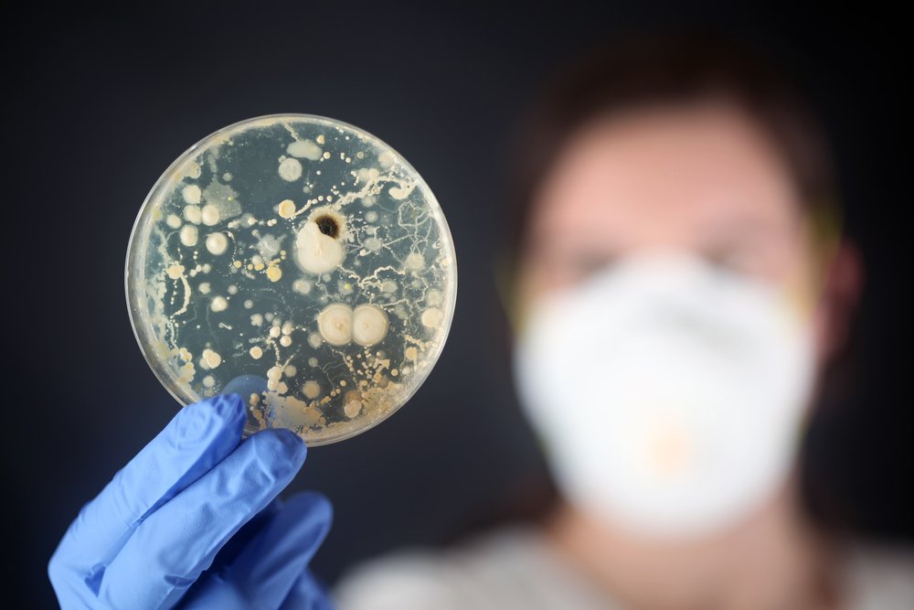 Что представляют собой условно-патогенные бактерии