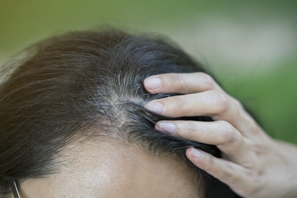 Основные причины появления ранней седины волос