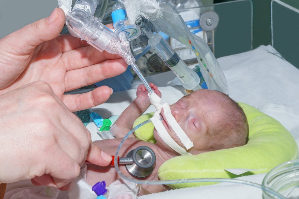 Дыхание для жизни ребёнка: роль сурфактанта