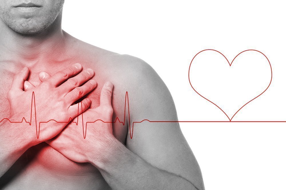 «Синдром праздничного сердца»: развитие аритмии