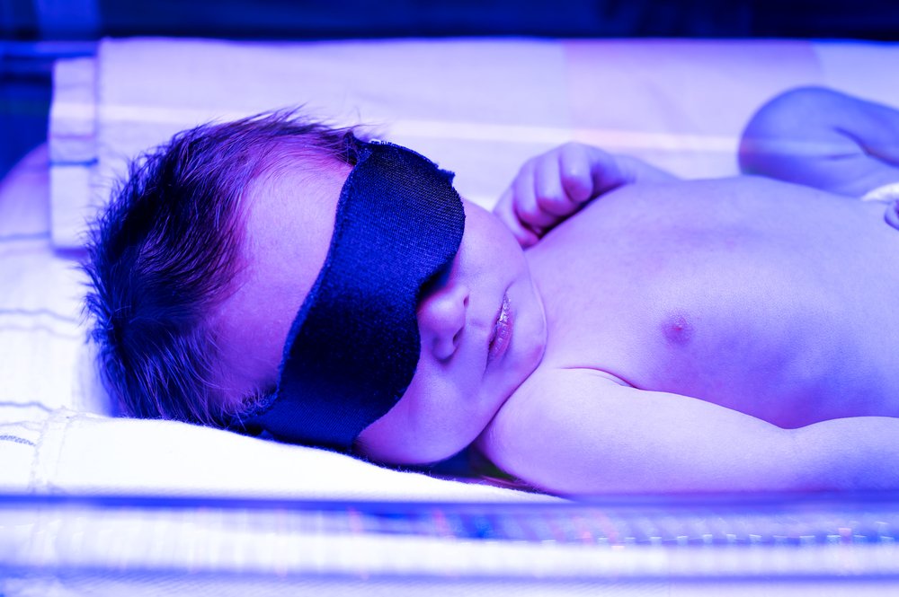 Домашняя фототерапия и желтуха у новорожденных