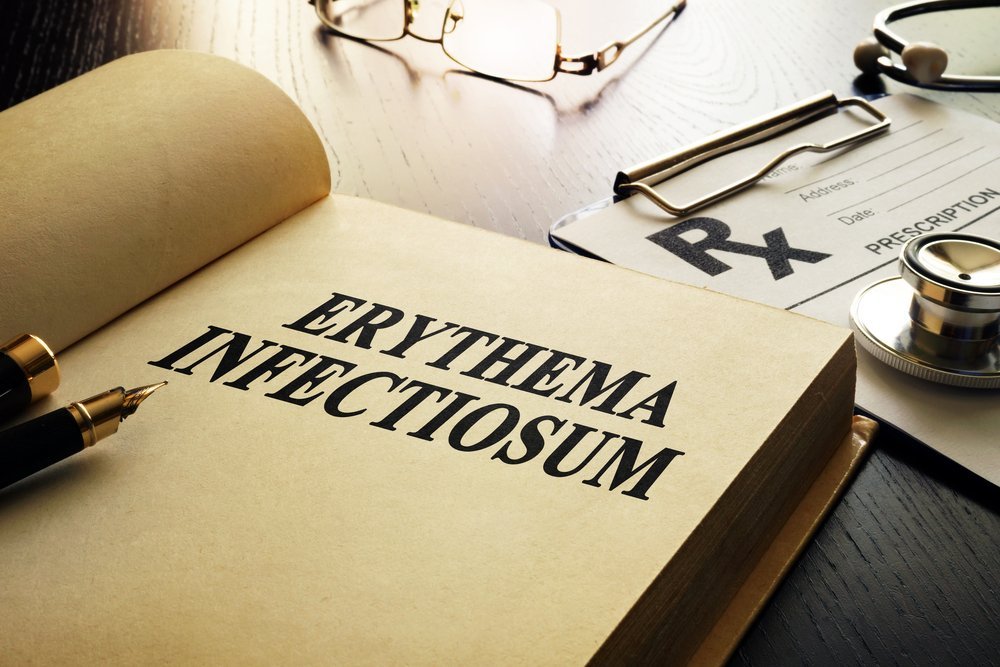 Инфекции и патологии как причины эритемы