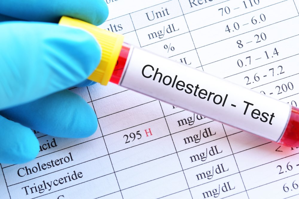 Анализ на холестерин и другая диагностика