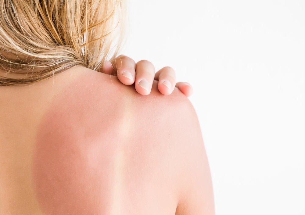 Какой вред красоте кожи наносит избыток ультрафиолета?