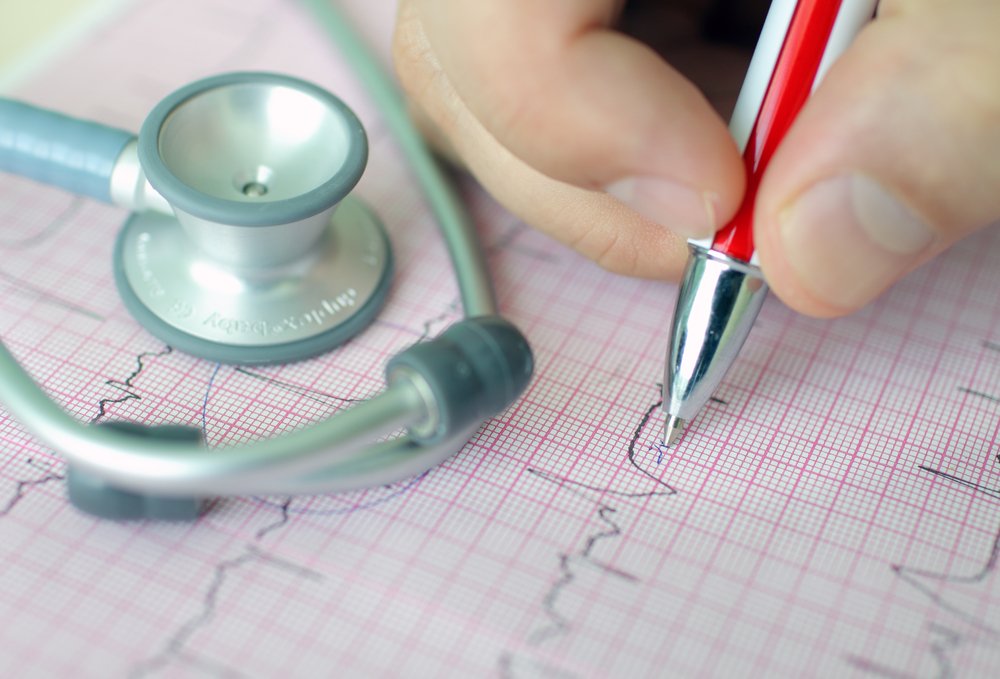 Когда при брадикардии нужна запись к кардиологу?