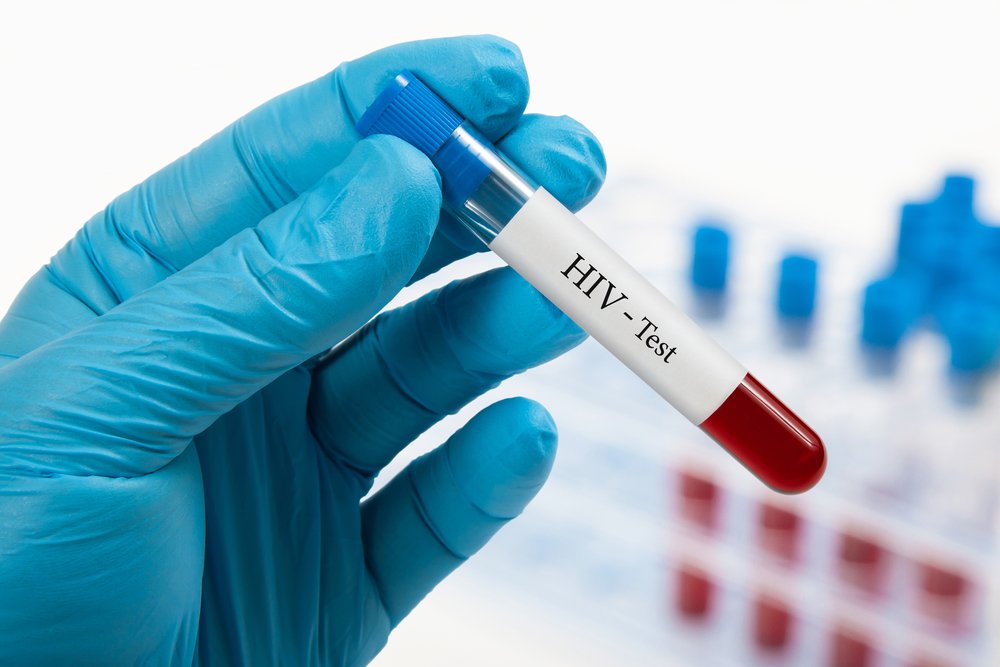 Тест на ВИЧ – что это за метод?