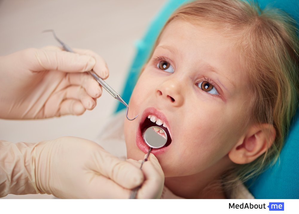 Симптомы кариеса молочных зубов у детей