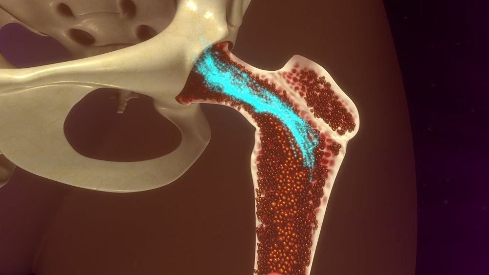 Что такое костный мозг и зачем нужна его трансплантация
