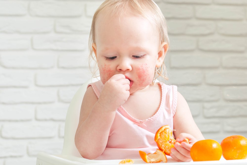 Когда вводить аллергенные продукты в рацион ребёнка?