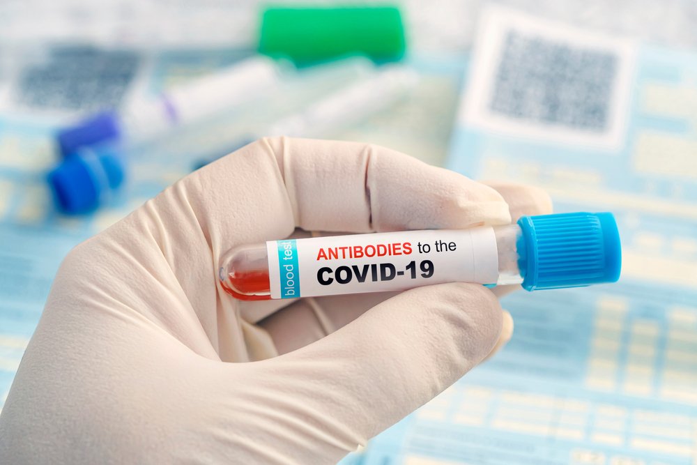 Надо ли проверять наличие антител после вакцинации?