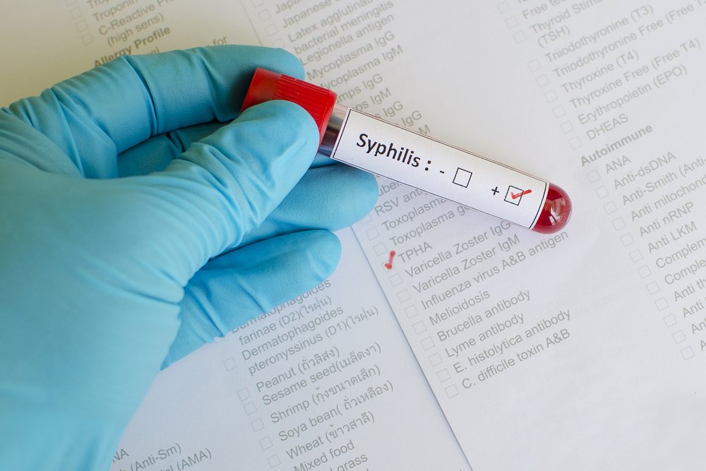 Обследование на сифилис беременных женщин