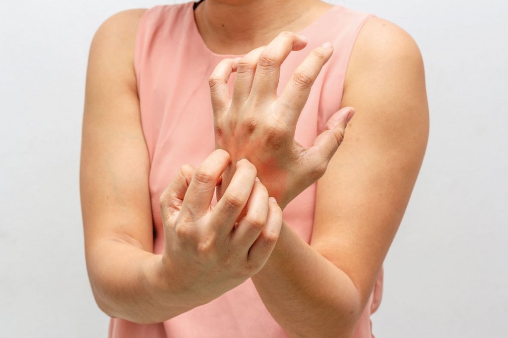 Симптомы лекарственного гепатита: желтуха, тошнота, зуд кожи