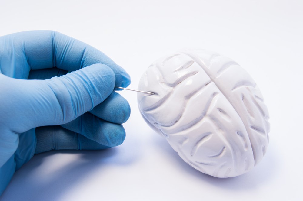 Как проявляются метастазы в головном мозге?