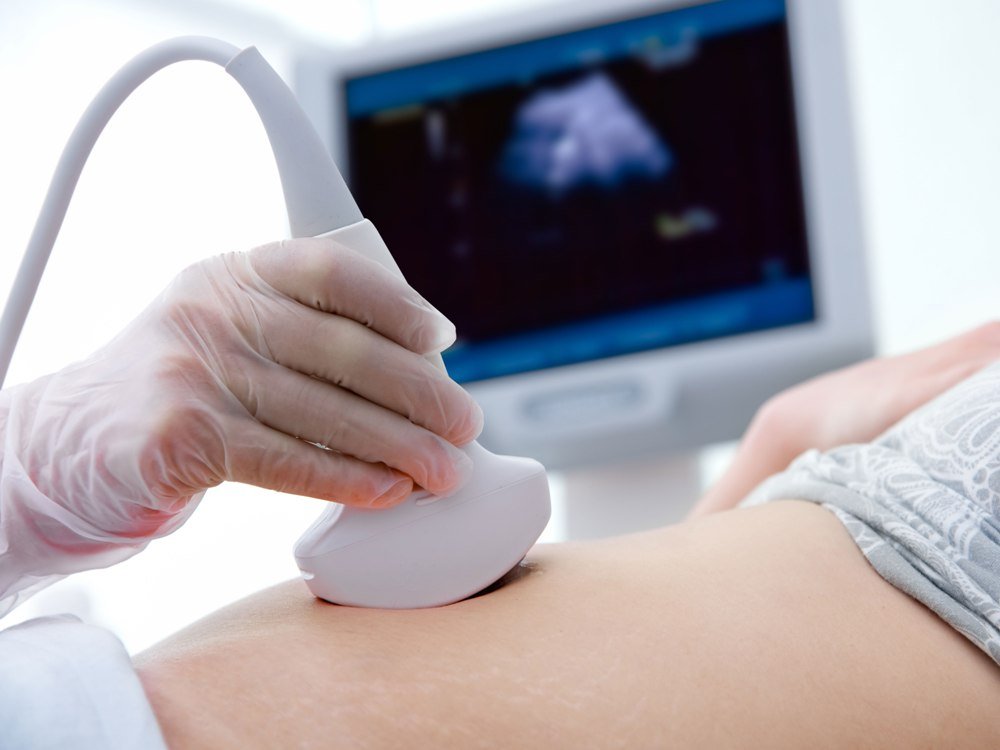 Как проходит диагностика внематочной беременности?